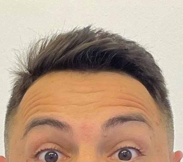 Antes do procedimento