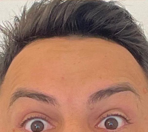 Depois do procedimento
